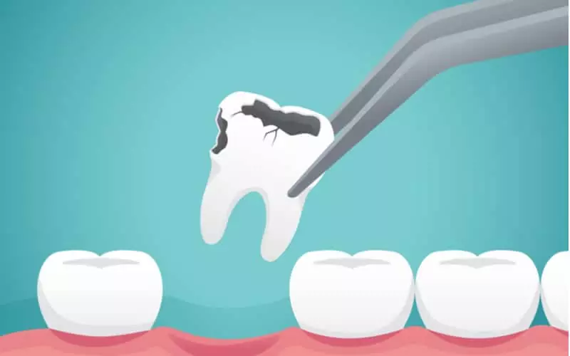 Colina Dental's full mouth reconstruction procedures